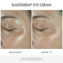 Load image into Gallery viewer, Obagi Medical ELASTIderm Eye Cream, Firming Eye Cream for Fine Lines and Wrinkles, Ophthalmologist Tested, 0.5 oz Pack of 1 - foxberryparkproducts