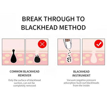 Load image into Gallery viewer, Blackhead Remover Deep Pore Cleaner  Facial SPA - foxberryparkproducts