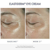 Obagi Medical ELASTIderm Eye Cream, Firming Eye Cream for Fine Lines and Wrinkles, Ophthalmologist Tested, 0.5 oz Pack of 1 - foxberryparkproducts