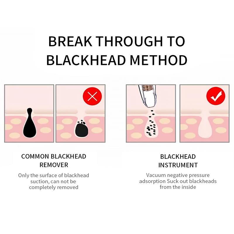 Blackhead Remover Deep Pore Cleaner  Facial SPA - foxberryparkproducts
