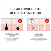 Blackhead Remover Deep Pore Cleaner  Facial SPA - foxberryparkproducts