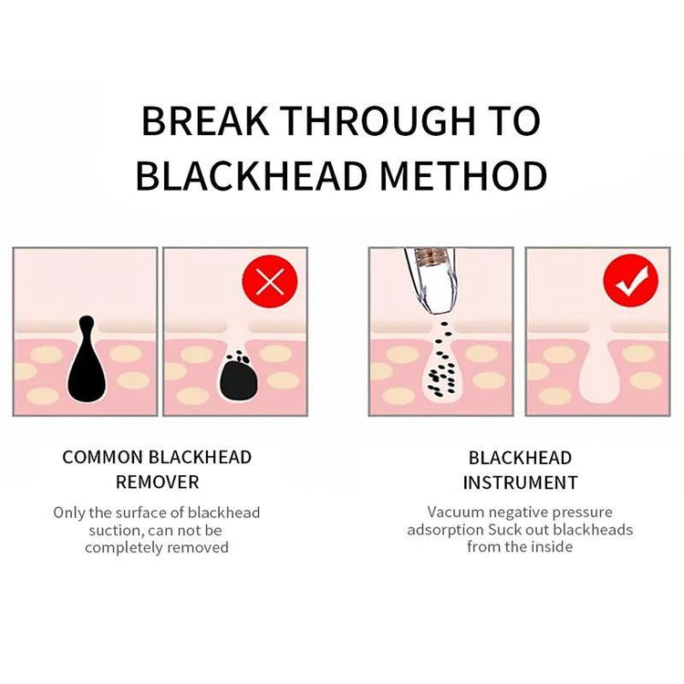 Blackhead Remover Deep Pore Cleaner  Facial SPA - foxberryparkproducts