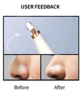 Blackhead Remover Deep Pore Cleaner  Facial SPA - foxberryparkproducts